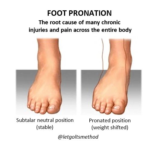 what is pronation overpronation supination, February 2020