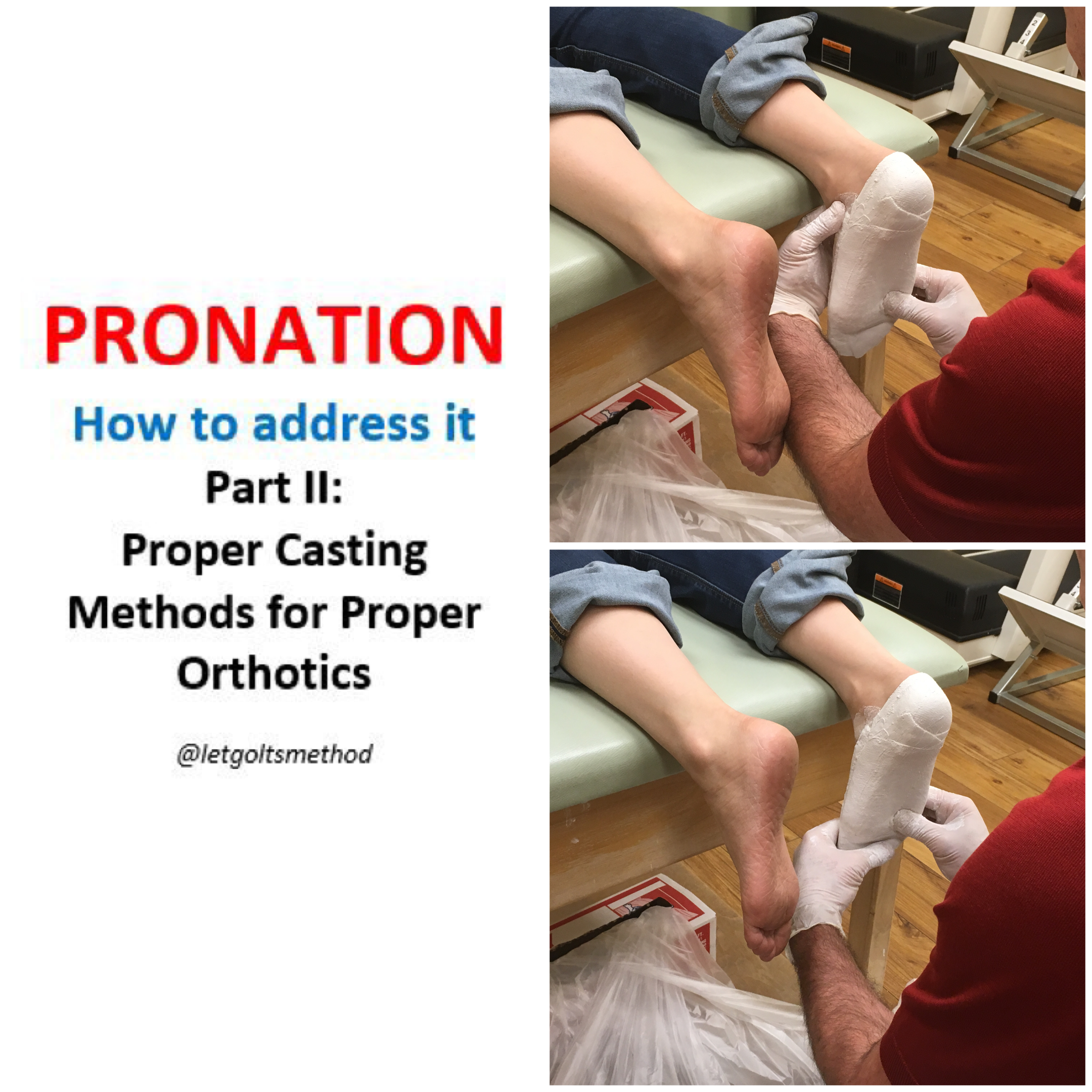 orthotics to correct pronation